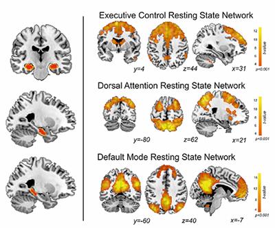 Verbal Learning and Longitudinal Hippocampal Network Connectivity in Temporal Lobe Epilepsy Surgery